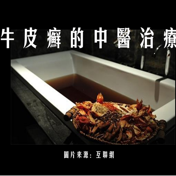牛皮癬的中醫治療