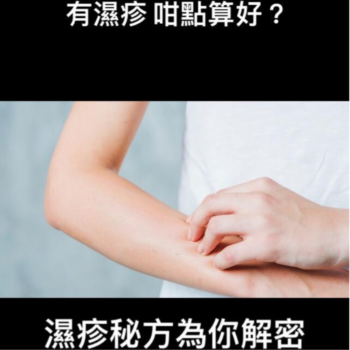 從內到外打倒濕疹秘方