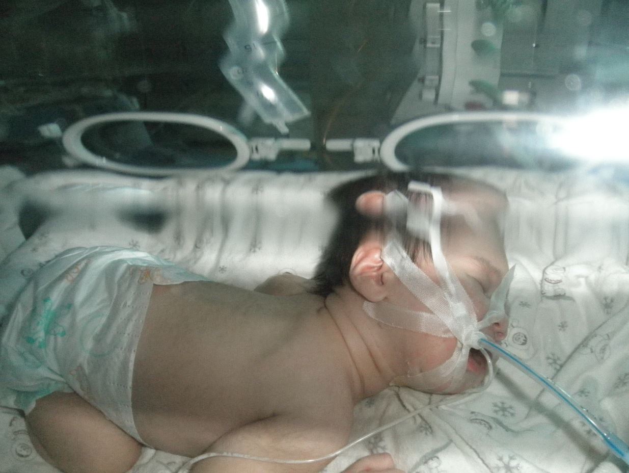 他們曾徘徊死亡邊緣 - 初生嬰兒