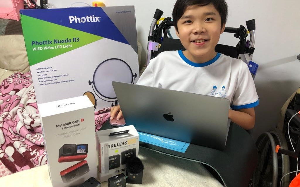 [ Chasing his Dream ] A Child with Rare Disease Dreams of being a Director