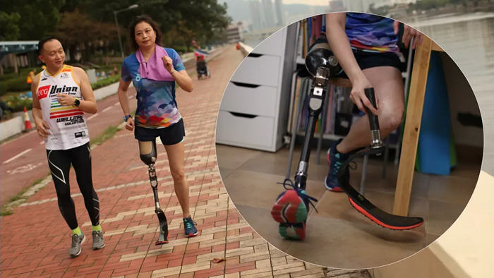 封面名人：弱聽 截肢 腫瘤 刀片人跑出馬賽克人生